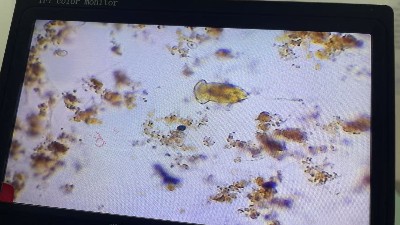 好氧池褐色泡沫的成因分析与解决方案